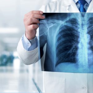 Chequeo pulmonar