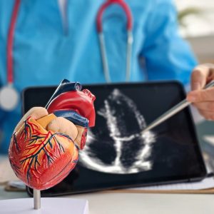 Ecocardiograma