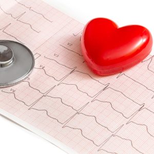 Electrocardiograma